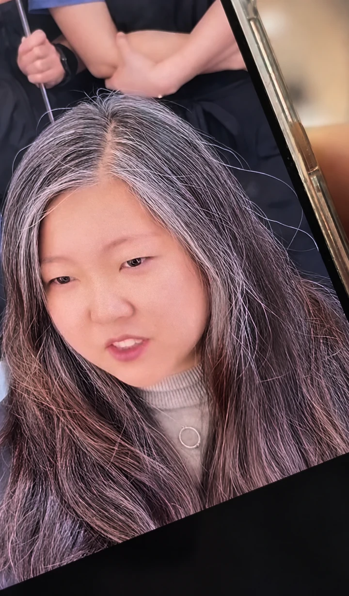 새치 고민 고객 시술 전